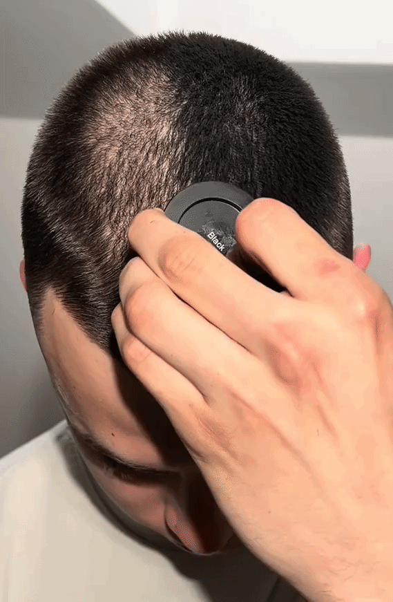 Perfect Hairline In 10 Seconds